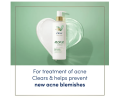 Dove Body Love Body Cleanser Acne Clear 17.5 fl oz
